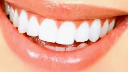 Dentiste Nouméa - Cabinet Dentaire du Docteur Pascal LIONNET – Nouméa