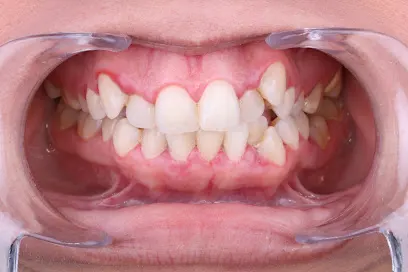 Zental Odontología - Cumbres - Clínica Dental Monterrey – Monterrey