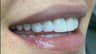 Phoenix Dental Clinic - Dr Rassi – Beirut