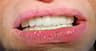 Helou Dental Clinic – غزير