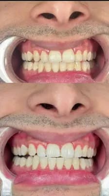 Ultra Dental Clinic