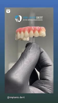 Implanto Dent