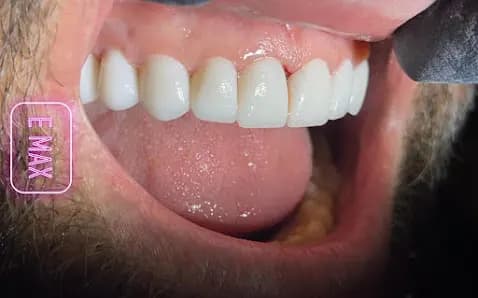 Gulan smile center