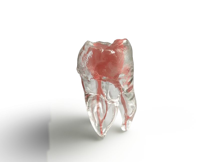 Traning simulation Block for root canals, NIC