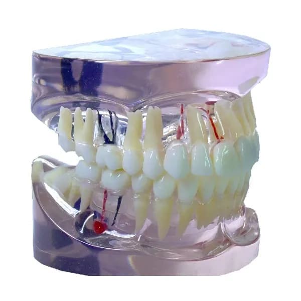 MediPros® Transparent Disease Model