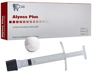 DSI Alyoss