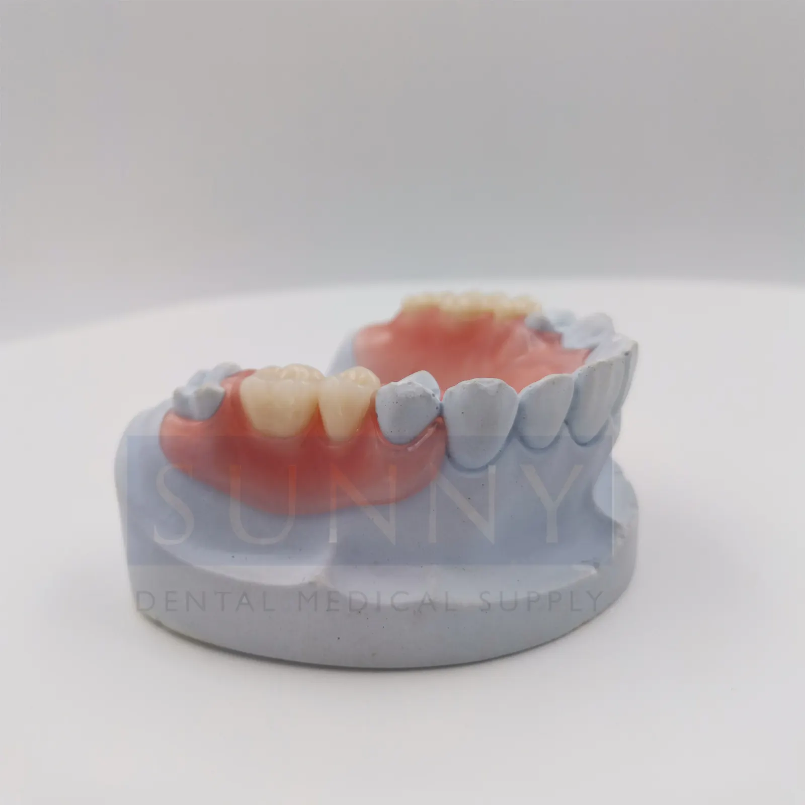 Flexible Denture (Valplast®)