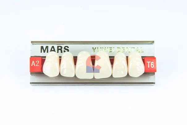 MARS Pontics T6 A2