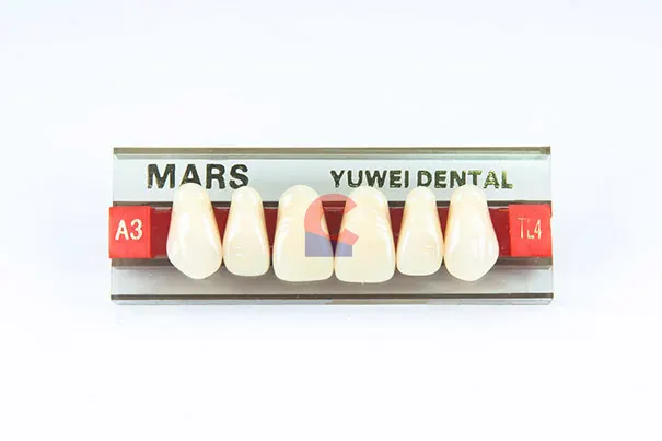 MARS Pontics TL4 A3