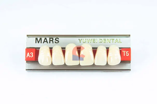 MARS Pontics T5 A3