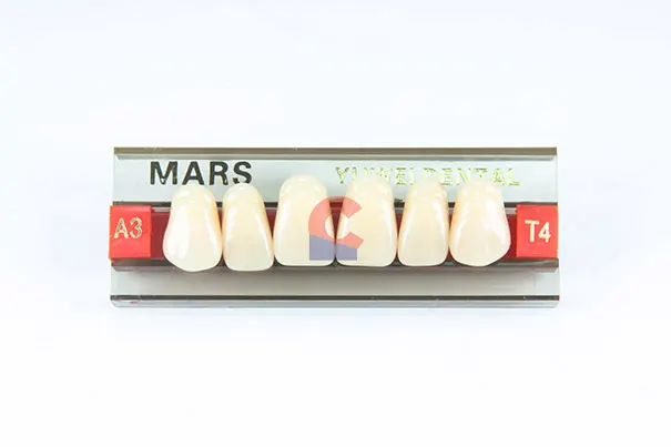 MARS Pontics T4 A3