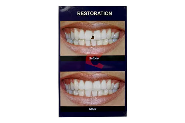 Poster Restoration