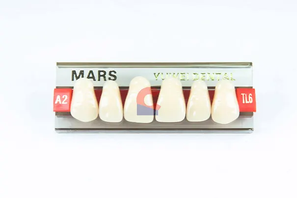 MARS Pontics TL6 A2
