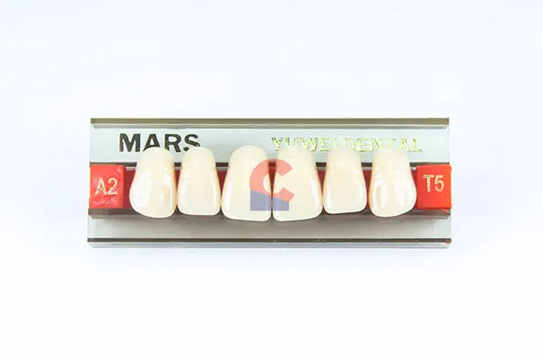 MARS Pontics T5 A2