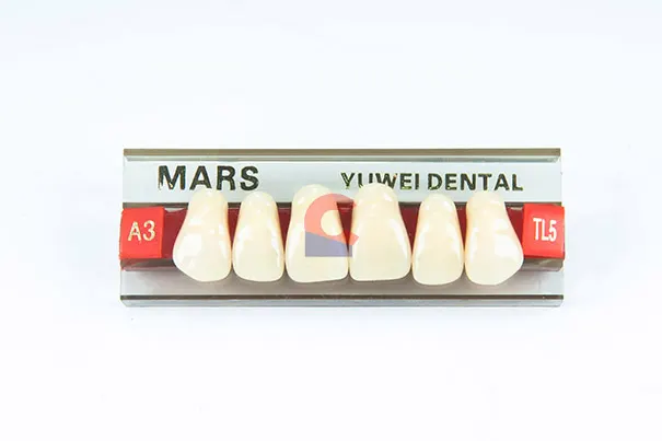 MARS Pontics TL5 A3