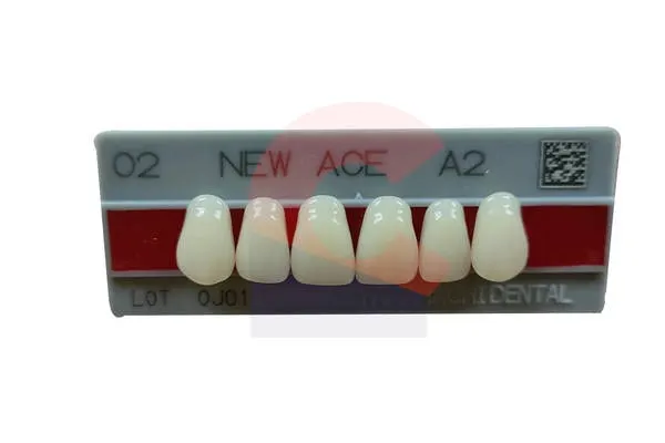 New Ace Pontics O2 A2