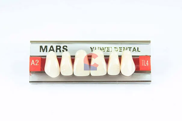 MARS Pontics TL4 A2
