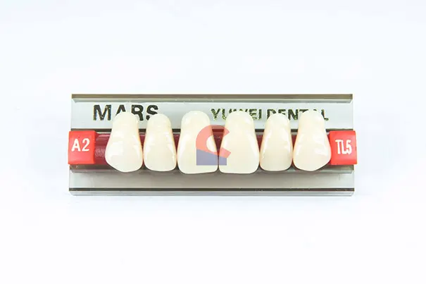 MARS Pontics TL5 A2