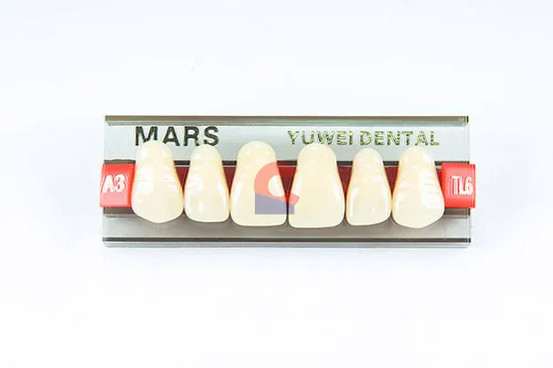 MARS Pontics TL6 A3
