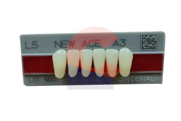 New Ace Pontics L5 A3