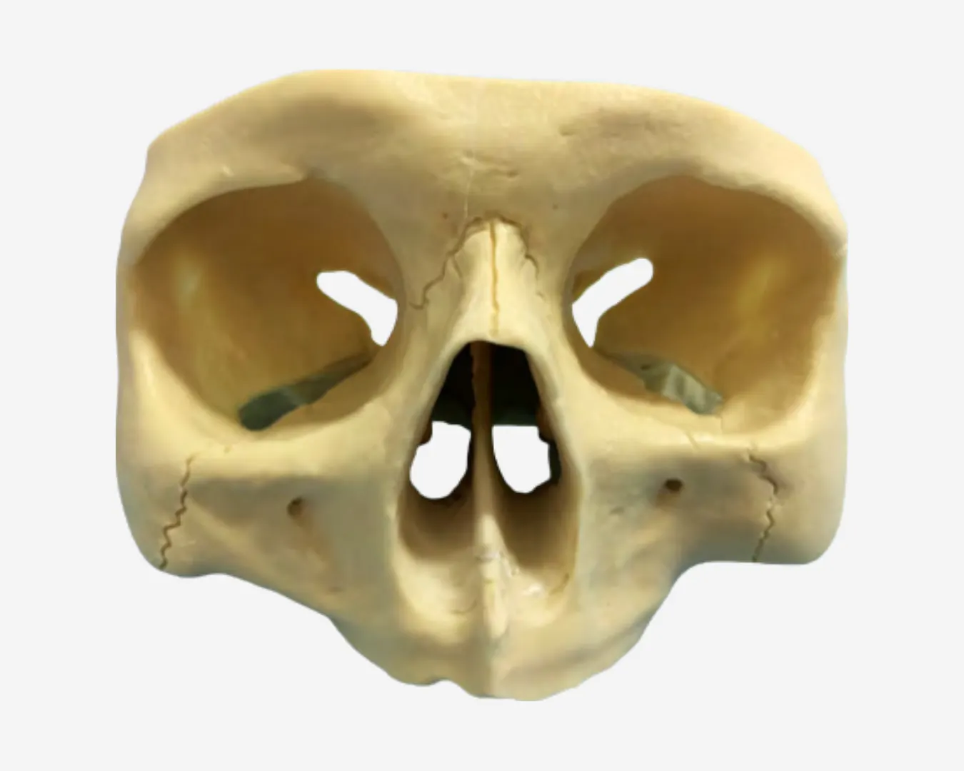 FULL ARCH TREATMENT MODELS – ZYG 101
