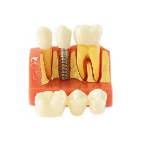 HST IMPLANT MODEL – Pink
